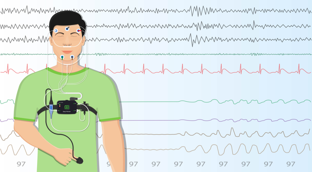 sleep study scoring services outsourcing