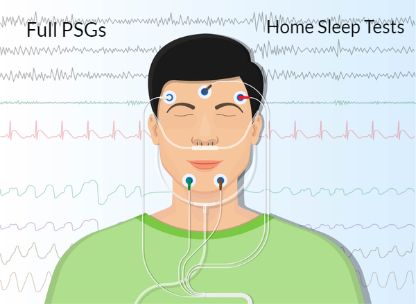 RPSGT scoring services for psg and home sleep testing